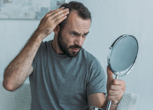 Photo of a man checking for hair loss on his scalp